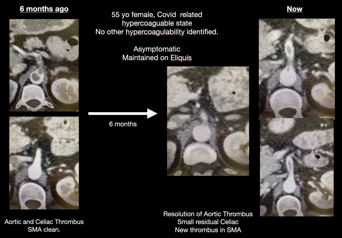 Alan Lumsden, MD, CV Chairman/Director tweet media