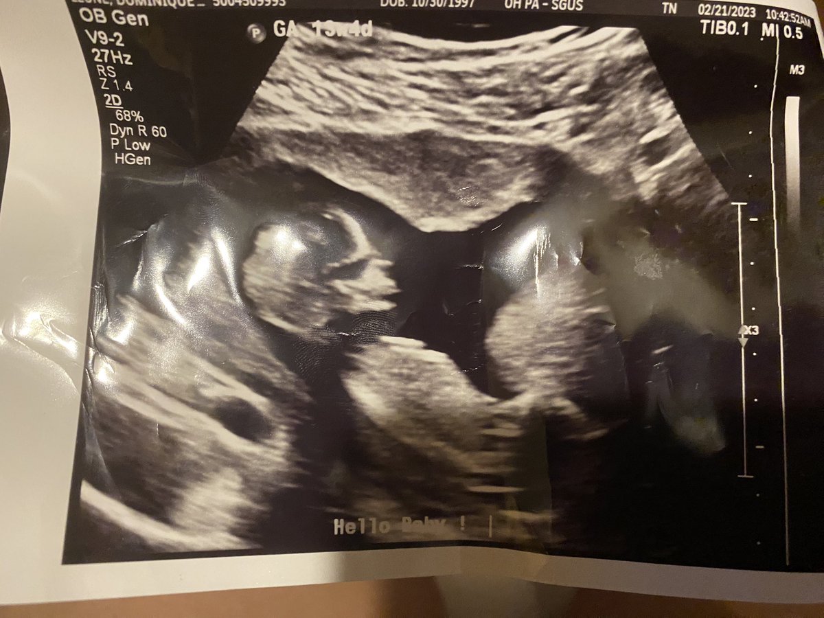 _niquerose's tweet photo. Mama of two 
💕💙 
And two under two like who would of thought https://t.co/IlEnEAckFm