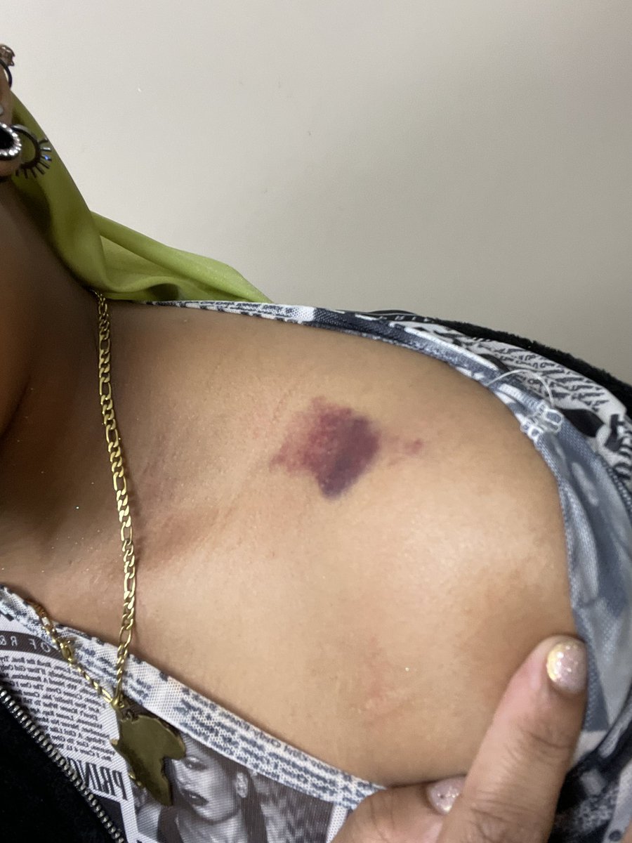 sugspicenotnice's tweet photo. Jason physically assaulted me - picked me up, threw me around, choked me, and slammed me into a door because I 

*check notes* 

called his brother weird and fucked up for not allowing me to stay at their house when I have nowhere else to go https://t.co/5OHDId79f8