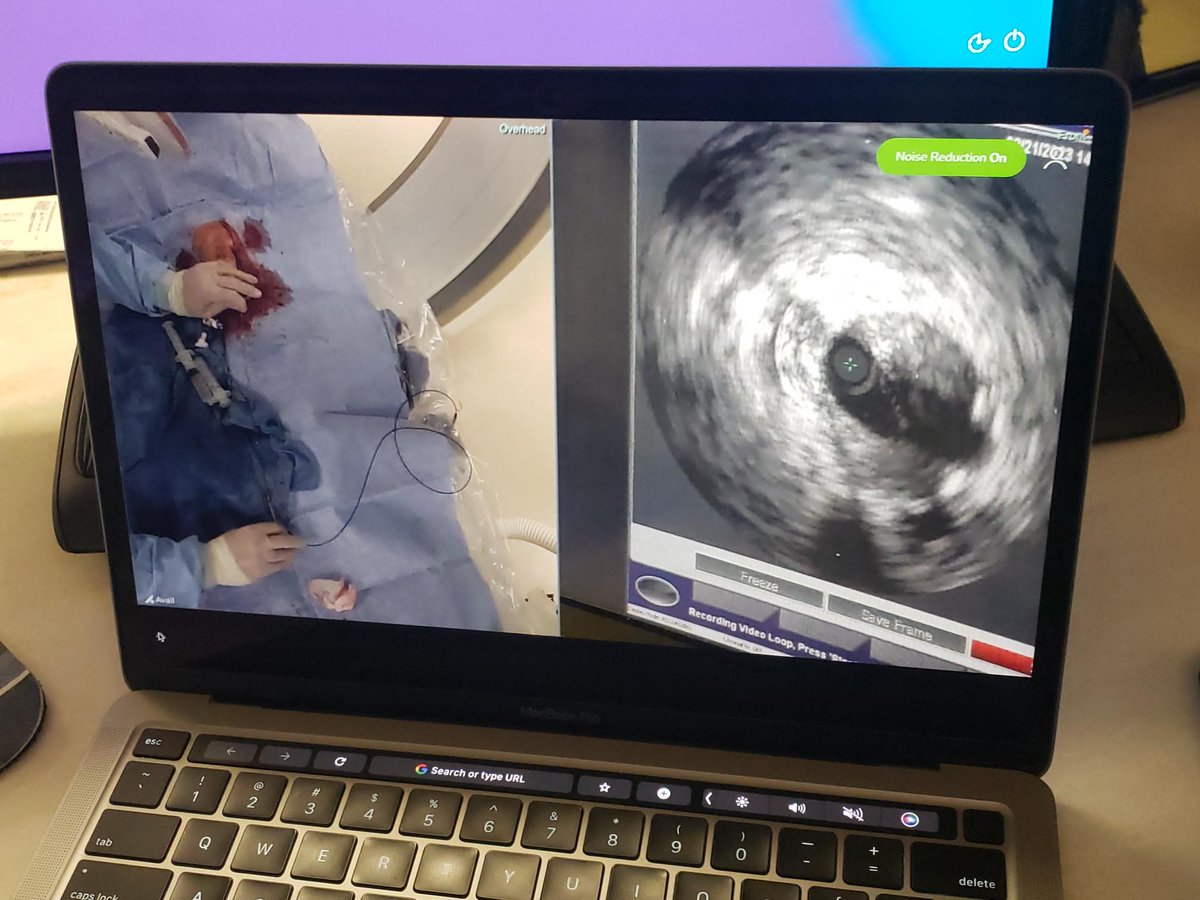 AvailMedsystems's tweet photo. On demand, peer-to-peer education made simple with the help of Avail. Congrats, @sna129 and the #interventionalcardiology team at @NFultonHospital! https://t.co/QBO5TNDZNR