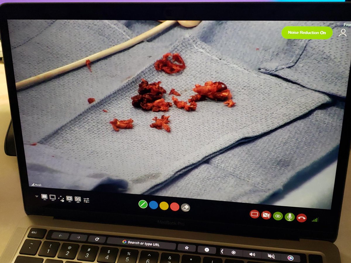 AvailMedsystems's tweet photo. On demand, peer-to-peer education made simple with the help of Avail. Congrats, @sna129 and the #interventionalcardiology team at @NFultonHospital! https://t.co/QBO5TNDZNR