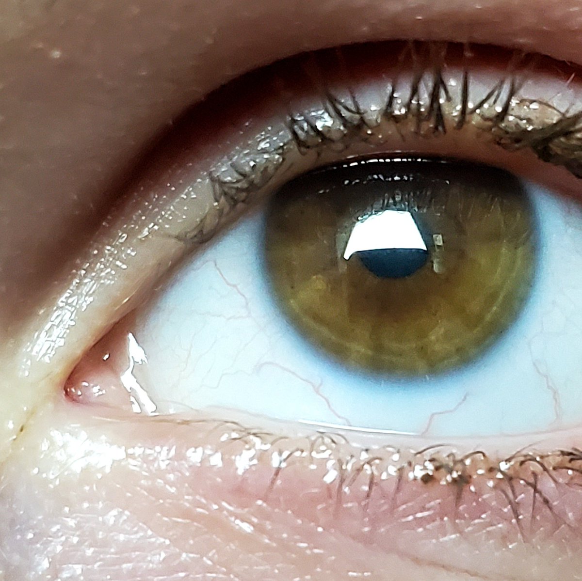 Inverted_Emma's tweet photo. I hated my eyes for so many years, but recently I realized my eyes have tree rings. https://t.co/drGmnjiWIa