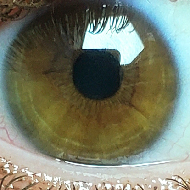 I hated my eyes for so many years, but recently I realized my eyes have tree rings.