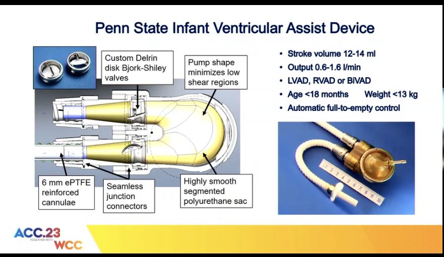 Great #ACC23 #ACCACPC session with an even amazing title: Not just Sci-Fi: Disrupters in Pediatric and Congenital Heart Disease.
Amazing talks on:
🫀Power of AI in Pt care
🫀Myocardial regeneration
🫀Innovations in VAD
🫀Fontan Assist devices
🫀4D Flow 
<a href="/ACCinTouch/">American College of Cardiology</a> #WCCardio