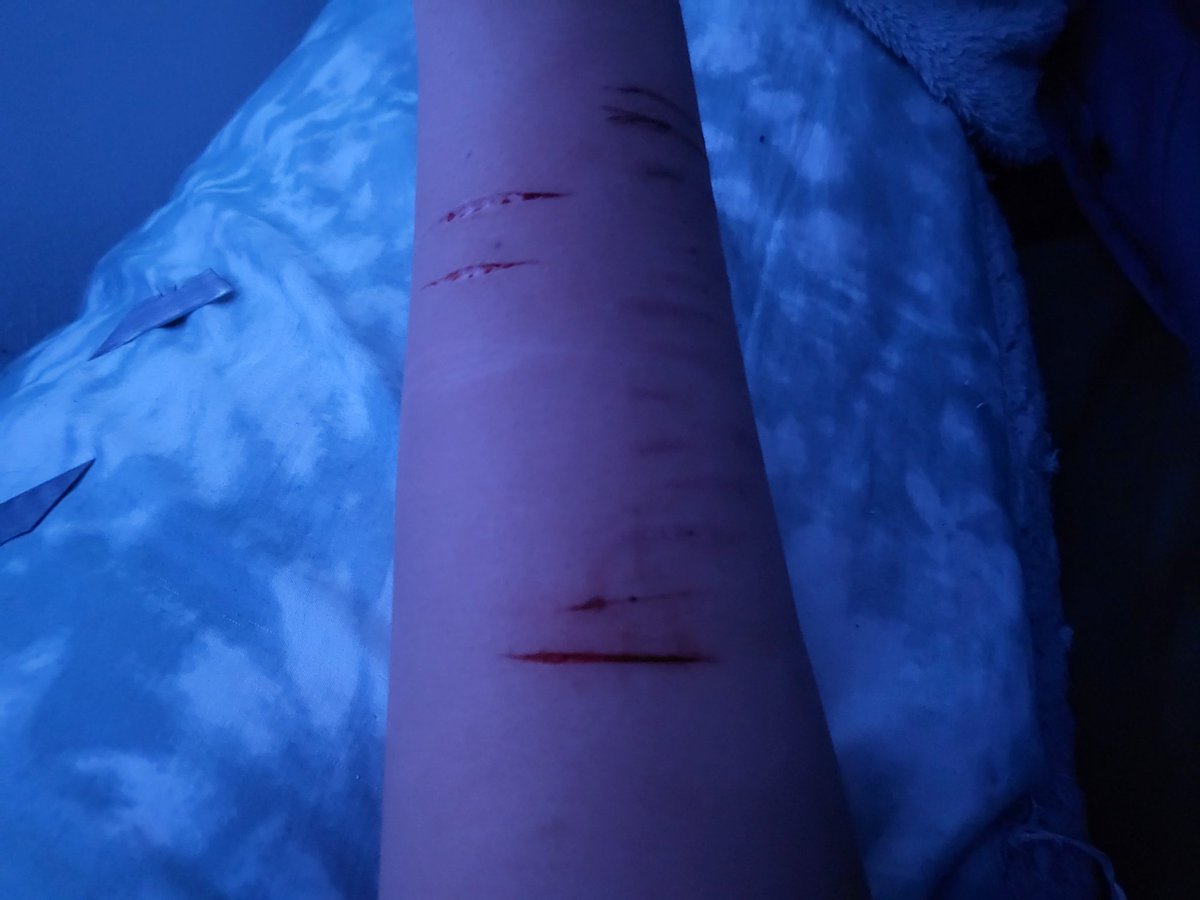 oxn_xi's tweet photo. MAKEUP 
#SHTWT 
#SHTWTMOOTS 
keeps getting deeper, and more I started bruising myself https://t.co/wFZ2adQJcQ