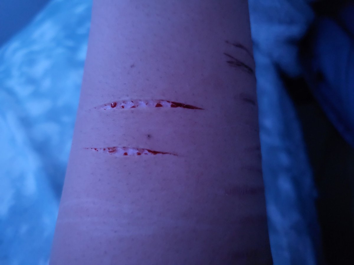 oxn_xi's tweet photo. MAKEUP 
#SHTWT 
#SHTWTMOOTS 
keeps getting deeper, and more I started bruising myself https://t.co/wFZ2adQJcQ
