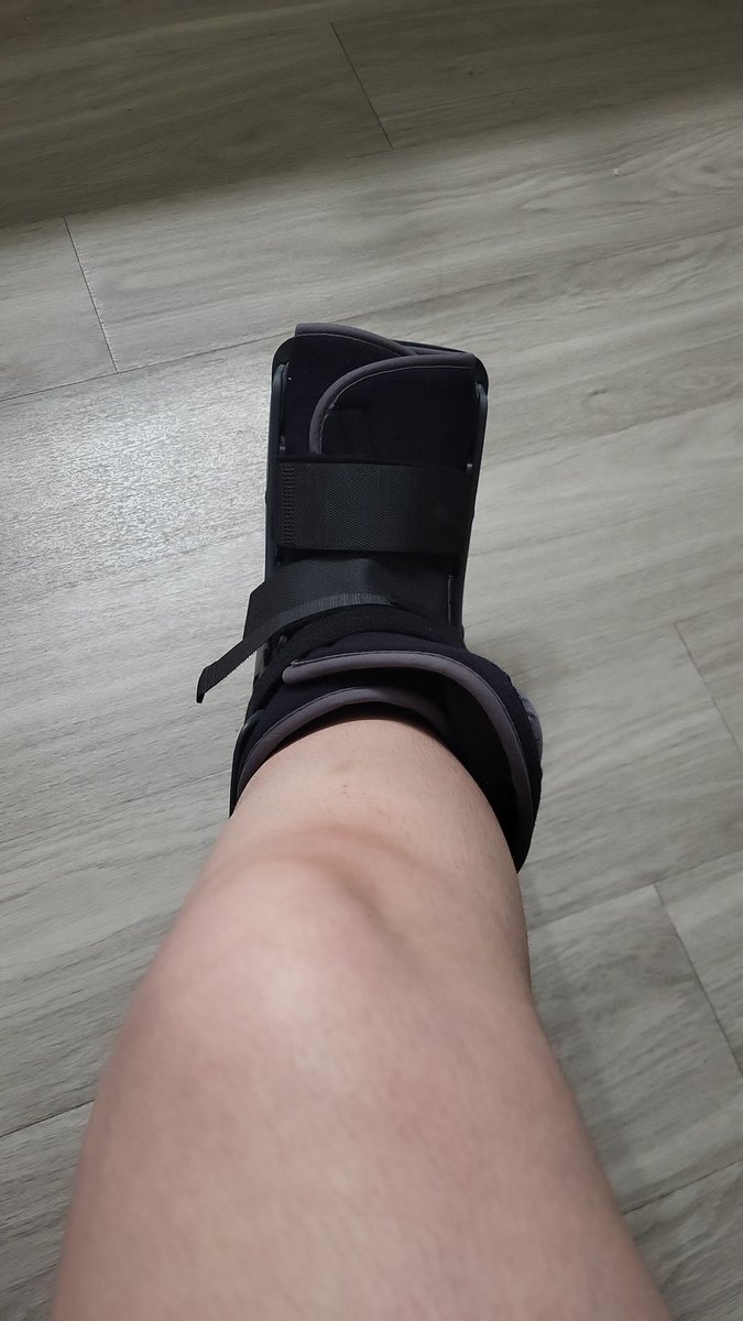 CurvyCurlyQueen's tweet photo. We've upgraded to a boot and crutches, my foot is so swollen and bruised under this 😩 https://t.co/ruVo4lAuv9