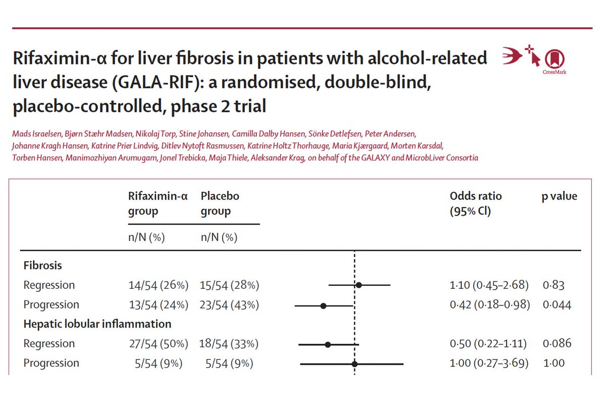 Mads Israelsen (@israelsenmads) on Twitter photo GALA-RIF is out in Lancet Gas Hep
Rifaximin-α seems to prevent worsening of alcohol-related liver disease
What a culmination of 8 years committed team work 🙌😅❤️
doi.org/10.1016/S2468-…
#livertwitter <a href="/LancetGastroHep/">The Lancet Gastroenterology & Hepatology</a> <a href="/EricTopol/">Eric Topol</a> GALA-RIF is out in Lancet Gas Hep
Rifaximin-α seems to prevent worsening of alcohol-related liver disease
What a culmination of 8 years committed team work 🙌😅❤️
doi.org/10.1016/S2468-…
#livertwitter <a href="/LancetGastroHep/">The Lancet Gastroenterology & Hepatology</a> <a href="/EricTopol/">Eric Topol</a>