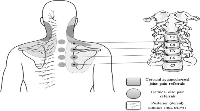 ClinicianBetter's tweet photo. Chronic pain and the thoracic spine! 

https://t.co/dffkgMhYbI https://t.co/njfhgEfmpH