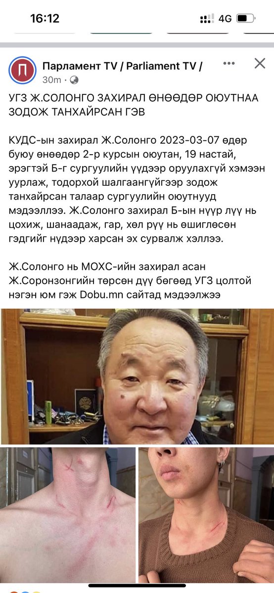 TULGA_'s tweet photo. Эднийхэн чинь яацарцан улсууд байдаг юм бэ? https://t.co/xnt1sQIpr9