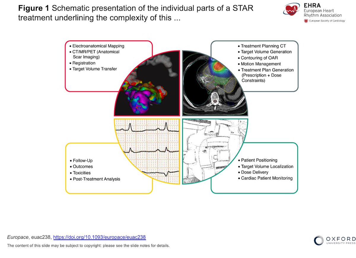The STOPSTORM publication by Grehn & Mandija et. al. is now live in #Europace! Current clinical cardiac radiotherapy #STAR shows areas of optimization/ harmonization: substrate mapping, target delineation, motion management, dosimetry, and QA : academic.oup.com/europace/advan… #epeeps