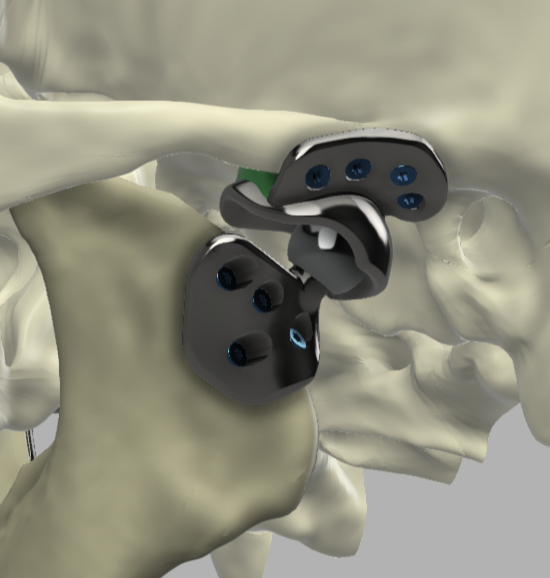 osteobionix tweet media