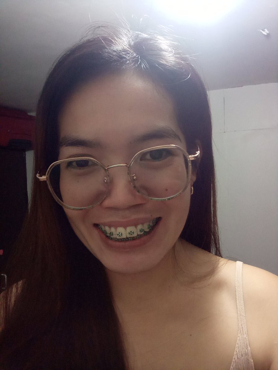 Rolieme22's tweet image. 87th day of braces 😁

#overbite