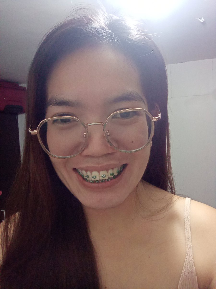Rolieme22's tweet image. 87th day of braces 😁

#overbite