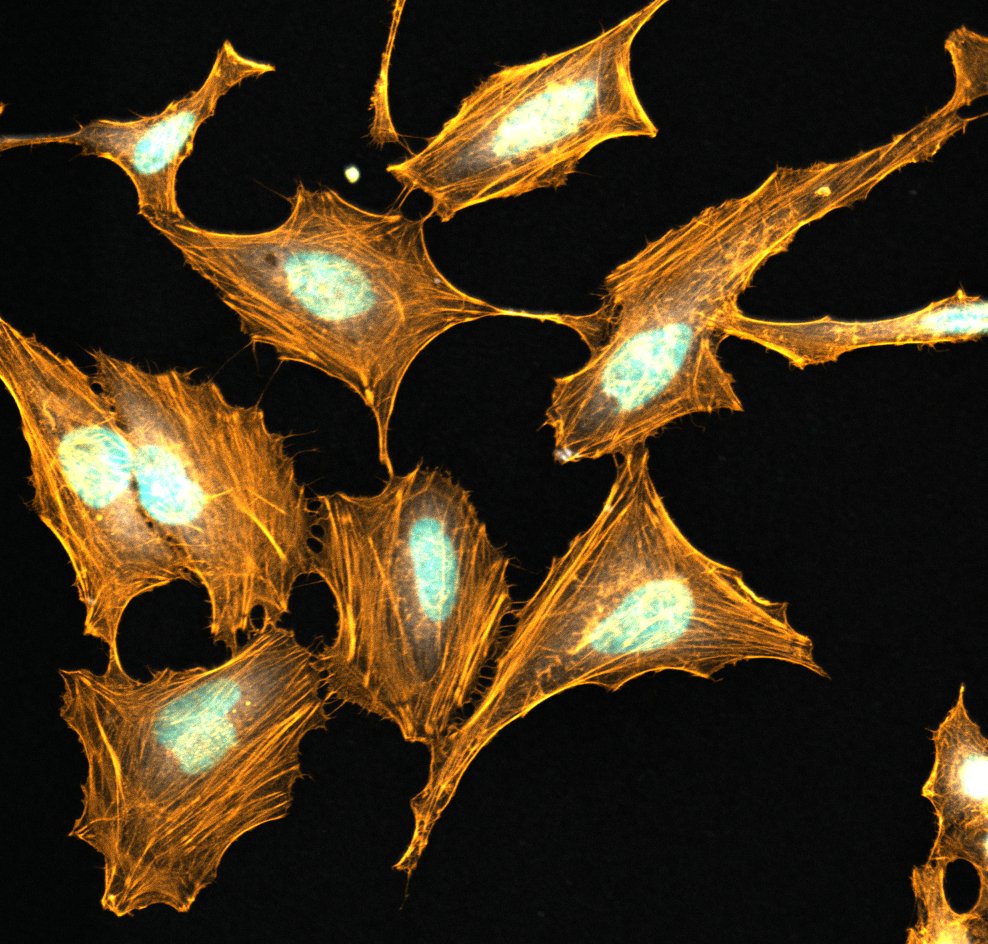 mpi_mr_hd's tweet photo. #MicroscopyMonday
Confocal image of fluorescent actin 🟠 and DNA 🔵 in HeLa cells. 📷@VictorMacarron https://t.co/NmPmBIatpL