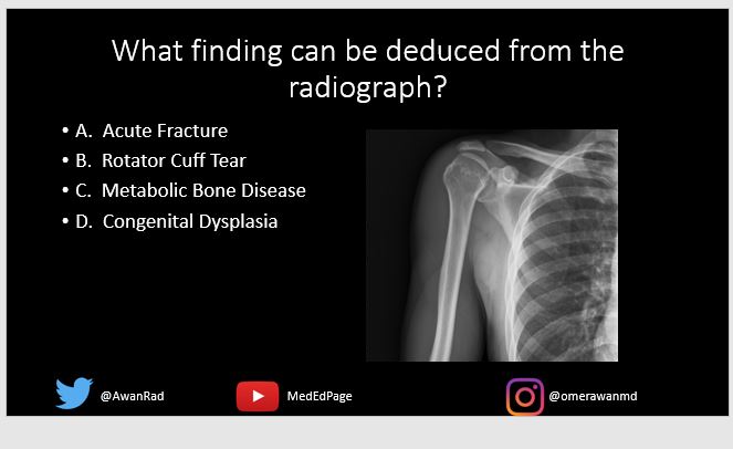 Omer Awan MD MPH (@awanrad) on Twitter photo NEW MSK CASE- #75- youtube.com/watch?v=imNlsw…. #MedEd #MedTwitter <a href="/_the_SRT/">The Society of Radiologists in Training</a> <a href="/mahad_minhas/">M&M, MD, MPH</a> <a href="/skeletalrad/">Angel Gómez-Cintrón, MD, MPH</a> @jennybencardino <a href="/Vilavaite/">María J. Díaz Candamio</a> <a href="/VivekKaliaMD/">Vivek Kalia, MD MPH</a> <a href="/RadDiscord/">RadDiscord</a> <a href="/FatimaElahi21/">Fatima Elahi</a> @AliTejaniMD <a href="/JacobFlemingMD/">Jacob Fleming, MD</a> <a href="/AminaFarooqMD/">Amina Farooq</a> <a href="/koolkpMD/">Kirang Patel, MD</a> <a href="/dflemosmd/">Diego Lemos</a> <a href="/MskSerme/">SERME</a> <a href="/TLHM_MD/">Tan-Lucien Mohammed, MD, FACR</a> @MohitAgNeurorad NEW MSK CASE- #75- youtube.com/watch?v=imNlsw…. #MedEd #MedTwitter <a href="/_the_SRT/">The Society of Radiologists in Training</a> <a href="/mahad_minhas/">M&M, MD, MPH</a> <a href="/skeletalrad/">Angel Gómez-Cintrón, MD, MPH</a> @jennybencardino <a href="/Vilavaite/">María J. Díaz Candamio</a> <a href="/VivekKaliaMD/">Vivek Kalia, MD MPH</a> <a href="/RadDiscord/">RadDiscord</a> <a href="/FatimaElahi21/">Fatima Elahi</a> @AliTejaniMD <a href="/JacobFlemingMD/">Jacob Fleming, MD</a> <a href="/AminaFarooqMD/">Amina Farooq</a> <a href="/koolkpMD/">Kirang Patel, MD</a> <a href="/dflemosmd/">Diego Lemos</a> <a href="/MskSerme/">SERME</a> <a href="/TLHM_MD/">Tan-Lucien Mohammed, MD, FACR</a> @MohitAgNeurorad