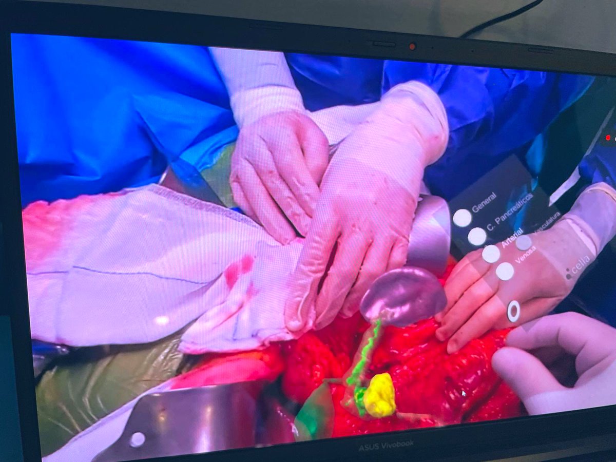 Trying new amazing toys…<a href="/CellaMedical3D/">Cella Medical Solutions</a> #ARglasses #pancreaticsurgery #HBP