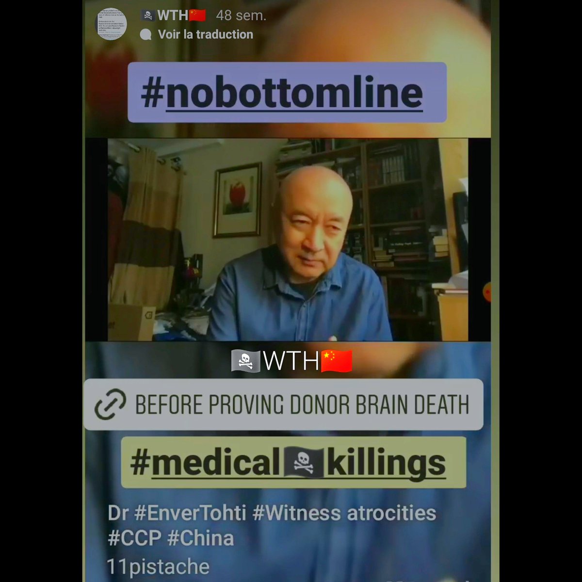 Pistache (@11pistache) on Twitter photo 2023-03-07 15:58:35 @MFA_China No internal affairs for crime against humanity:instagram.com/s/aGlnaGxpZ2h0…
#HRC52 #HRC #TheLastOfUs #HumanRights #UkraineRussianWar #China #Standup4HumanRights #COVID19 #coronavirus #CrimesAgainsHumanity #CCP #HealthForAll #Europe #DeadlineDay #Justice #WEF #WEF23 #Europa #OlafScholz @MFA_China No internal affairs for crime against humanity:instagram.com/s/aGlnaGxpZ2h0…
#HRC52 #HRC #TheLastOfUs #HumanRights #UkraineRussianWar #China #Standup4HumanRights #COVID19 #coronavirus #CrimesAgainsHumanity #CCP #HealthForAll #Europe #DeadlineDay #Justice #WEF #WEF23 #Europa #OlafScholz