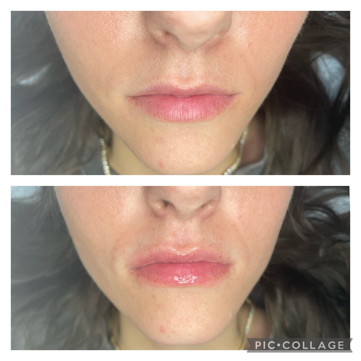 Exfoliate, hydrate, and plump your lips with our Hydrafacial™ Lip Perk 💋
Add it on to any facial service for only $40
📱 817.416.9366 to schedule!