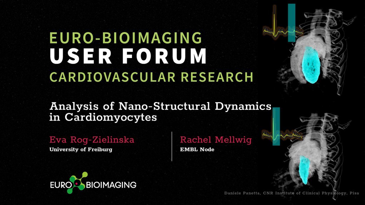 EuroBioImaging's tweet image. How can dual axis #electron #tomography support understanding the contraction–relaxation cycle of individual cardiomyocytes🤔? 
Eva Rog-Zielinska, @Uniklinik_Fr, explains her approach at the #EuroBioImaging User Forum on #Cardiovascular Research ⤵️ 
eurobioimaging.eu/news/analysis-…