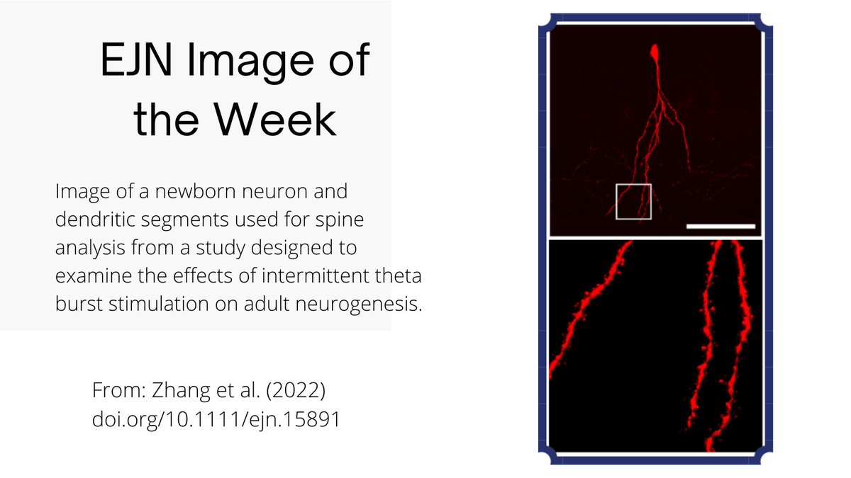 European Journal of Neuroscience tweet media