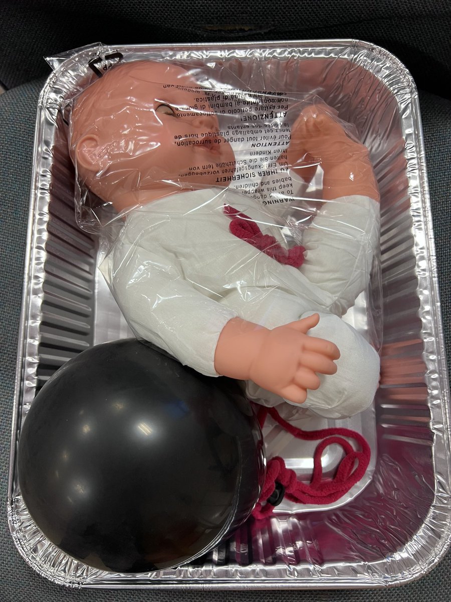 Dr Sarah Edwards (@drsarahedwards) on Twitter photo Local Emergency Medicine teaching <a href="/UHDBTrust/">University Hospitals of Derby and Burton NHS FT</a> with #lateralcanthotomy and #resusitativehysterotomy using <a href="/EM3FOAMed/">EM3FOAMed</a> drills by <a href="/FfionDavies4/">Ffion Davies ๐ด๓ ง๓ ข๓ ท๓ ฌ๓ ณ๓ ฟ</a> and myself.
<a href="/EMTAcommittee/">EMTA</a> <a href="/RCollEM/">Royal College of Emergency Medicine</a> Local Emergency Medicine teaching <a href="/UHDBTrust/">University Hospitals of Derby and Burton NHS FT</a> with #lateralcanthotomy and #resusitativehysterotomy using <a href="/EM3FOAMed/">EM3FOAMed</a> drills by <a href="/FfionDavies4/">Ffion Davies ๐ด๓ ง๓ ข๓ ท๓ ฌ๓ ณ๓ ฟ</a> and myself.
<a href="/EMTAcommittee/">EMTA</a> <a href="/RCollEM/">Royal College of Emergency Medicine</a>