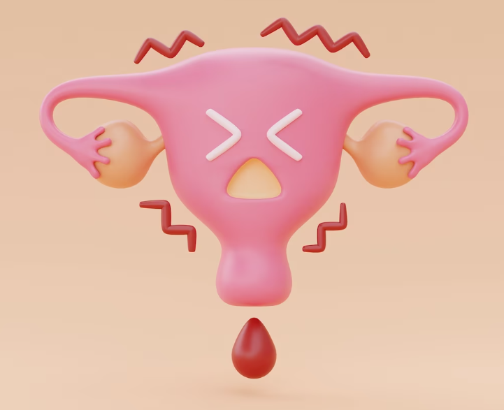 Medical_Videos's tweet photo. Endometriosis is a painful disorder in which tissue similar to the tissue that lines the inside of your uterus “the endometrium” grows outside your uterus. It becomes trapped and causes pain and complications such as cancer and infertility.
https://t.co/1Ok3sJPqES https://t.co/Idm4CsRKOw