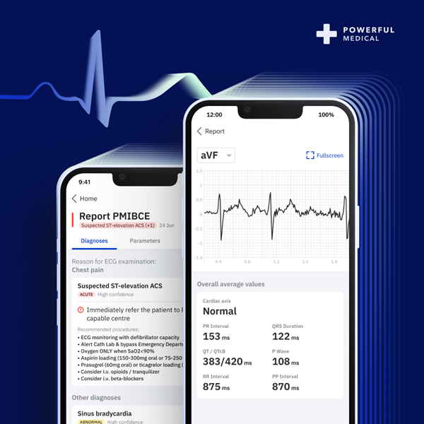 MedTechNow_'s tweet photo. new #innovations
@zimmerbiomet unveils latest enhancements to ZBEdge™ Dynamic Intelligence™ at #AAOS2023
@CN_Bio launches single-organ higher #throughput #microphysiological system
@PowerfulMedical launches PMcardio in UK, bringing #AI to #CardiovascularDiseases treatment https://t.co/VnWgzBcSK3
