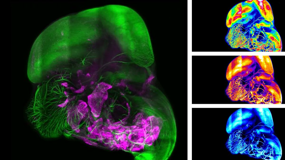luxendo's tweet photo. Cleared Mouse Brain – imaged with the Bruker’s Luxendo MuVi SPIM. 

Green - developing nerves; magenta - differentiating muscles. 
Sample c/o Glenda Comai, Institute Pasteur Paris, France

https://t.co/dtkfzNCodI 

#LSFM #lightsheet #SPIM https://t.co/H7GQgp0C1S