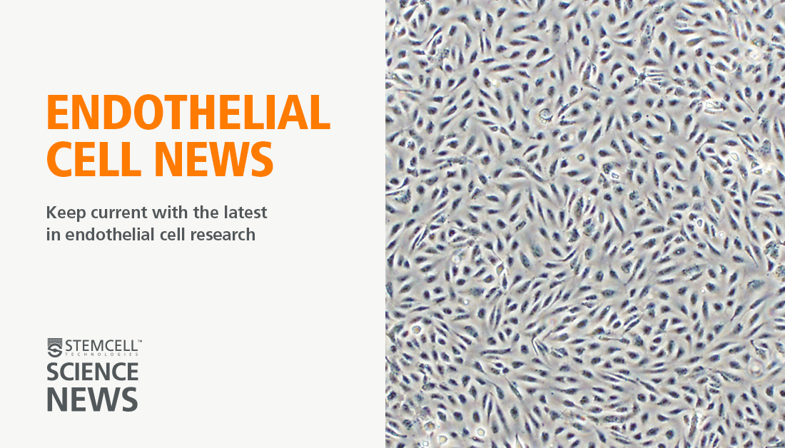 Looking for an easy way to stay up to date on #EndothelialCell News? 🧐 Check out the Science News website by @STEMCELLTech and subscribe to our weekly newsletters covering the latest research, reviews, industry news, and more. 👇

bit.ly/3Yrj9fp