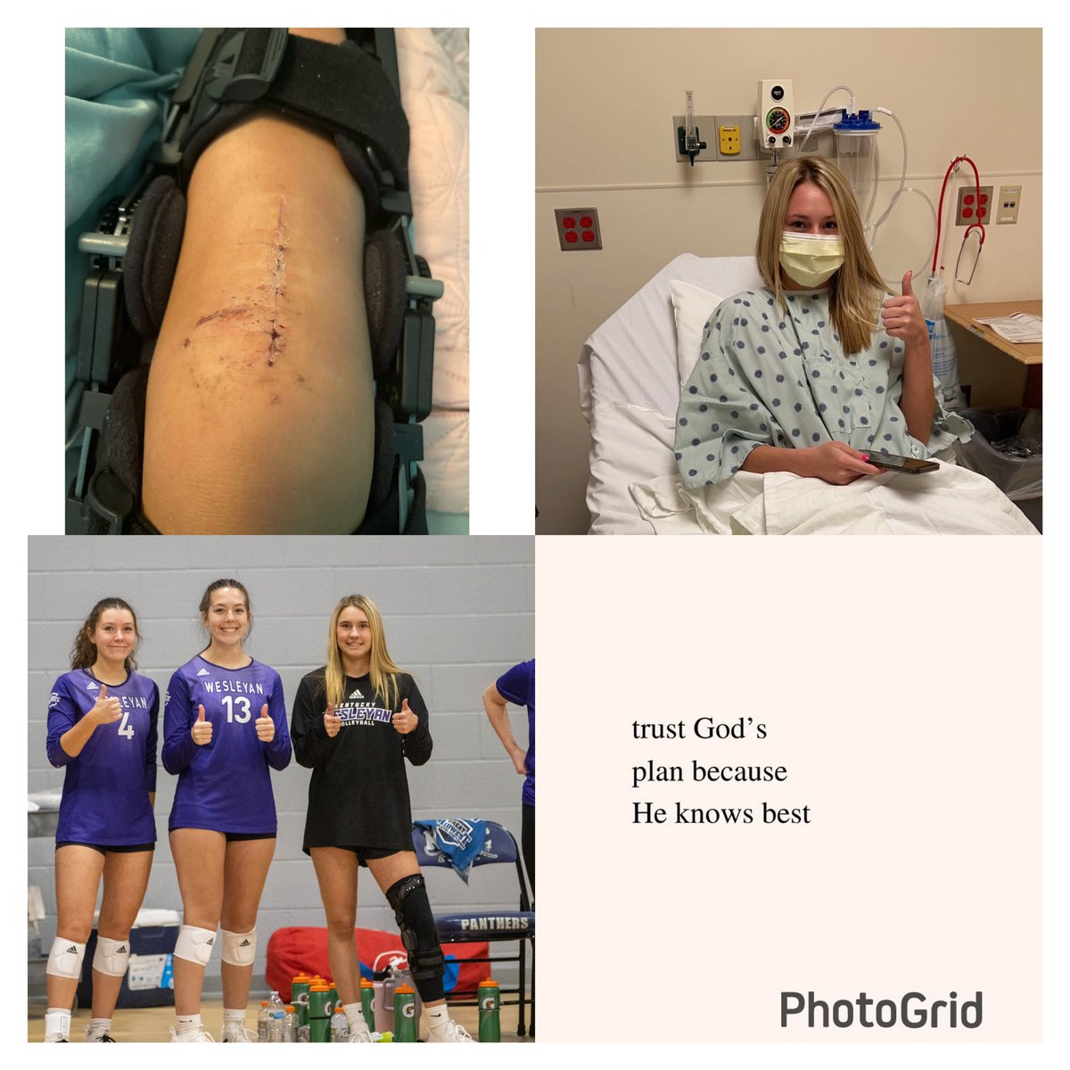 It’s been 314 days since my ACL reconstruction surgery &amp; I’m now officially cleared!! 2 Chronicles 15:7 🙏🏼