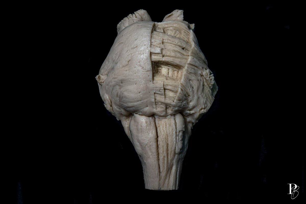 photobrain_mx's tweet photo. Brainstem. #photographer #neuro #neurosurgery #anatomy #medlife https://t.co/gnXvYqMKKU