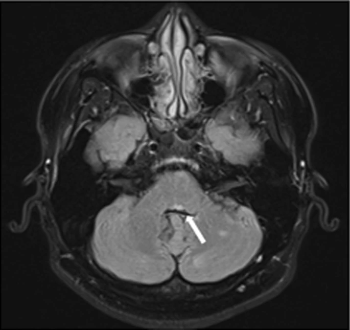 dr-brandon-beaber-on-twitter-23-year-old-male-with-eight-and-a-half