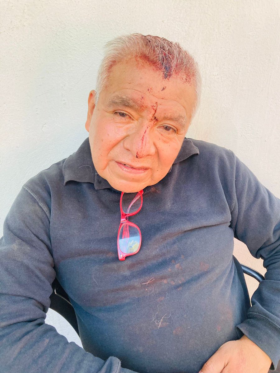 COPACO_Toriello's tweet image. Nos piden compartir
APOYO URGENTE 🚨 
#AlcaldíaTlalpan #TlalpanVecinos @TlalpanVecinos @TlalpanAl
@CarrascoTlalpan @TG_Tlalpan
¿ALGUIEN LO RECONOCE?
El Sr Ángel García de 66 años de encuentra muy desorientado y golpeado con una herida en la cabeza después de haber sido asaltado