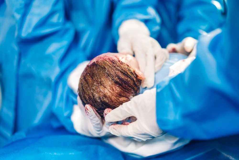 Defining Anesthesia Profitability- Read the Anesthesia Insider today> zurl.co/2KK5