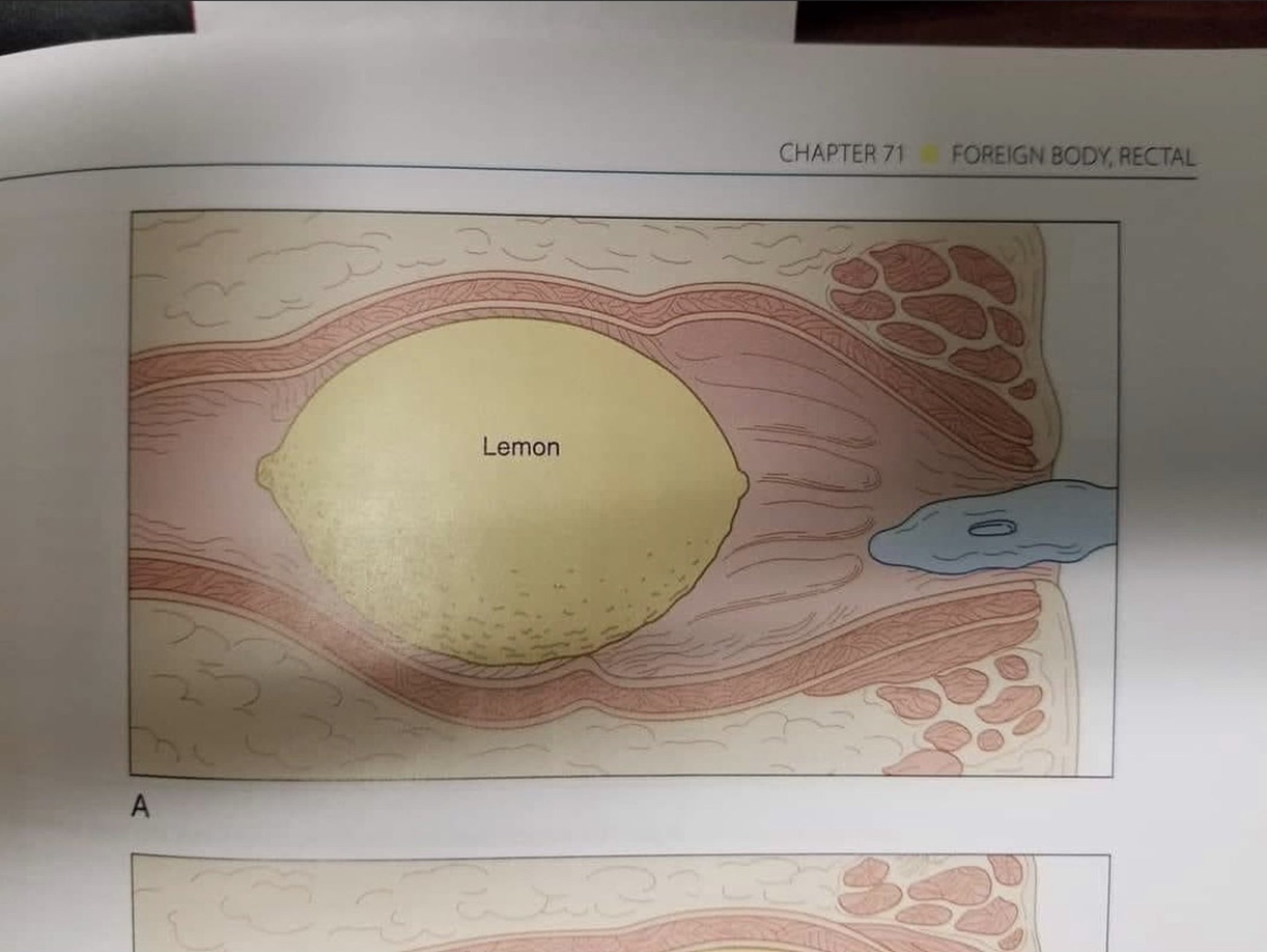 Chubbyemu on Twitter: “? https://t.co/Rz63xKOOJN” / Twitter