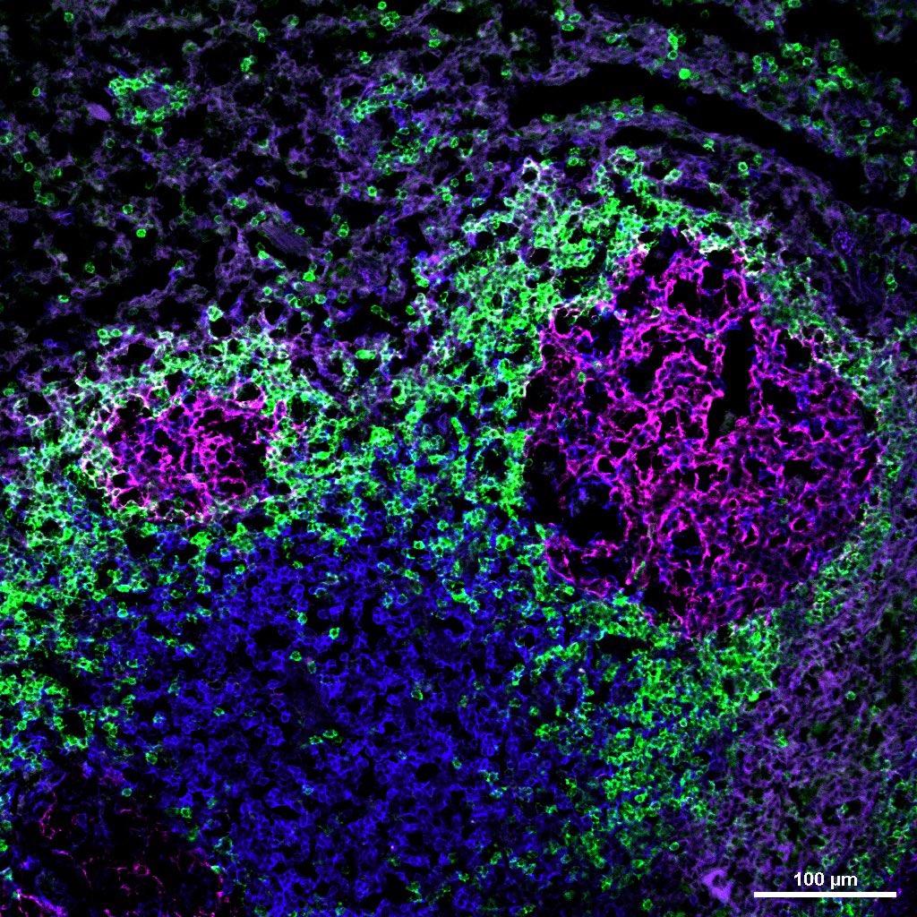 Today’s #GerminalCenter captured by the NikonA1R #Confocal is shaped like Mickey Mouse! Here, we have two GCs outlined in IgD (green) formed adjacent to the T cell Zone (blue) in the spleen of a mouse infected with malaria! CD35 (pink) intensity helps us orient our GC 🙂