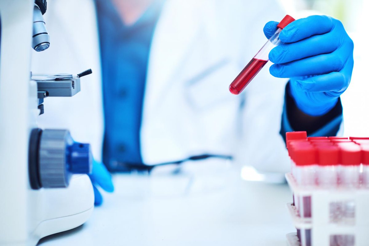 Hema_News's tweet photo. Researchers from @NU_Cancer demonstrate the 💉 therapeutic potential of direct targeting oncofusion genes by RNAi to treat #AML.

They provide proof for the feasibility of targeting 🎯 RUNX1/ETO in a pre-clinical setting.

@LeukemiaJnl | 🔗 https://t.co/vWh1udHNBb https://t.co/TQkSPe91tE