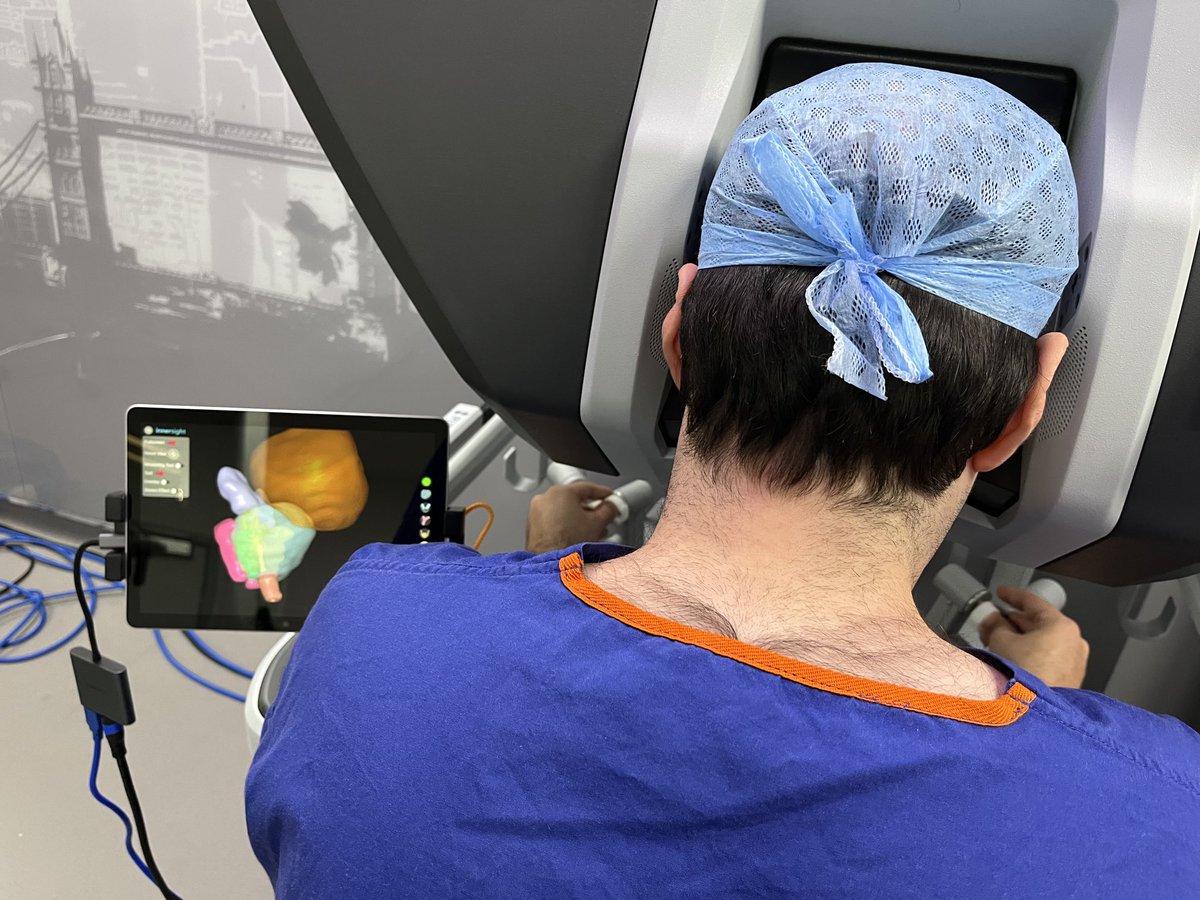 prokarurol's tweet photo. Image guided #robotic prostatectomy using ⁦@innersightlabs⁩ a startup from ⁦@KingsImaging⁩ 
Supported by ⁦@TUF_tweets⁩ 

The exquisite 3D detail can “fly in” to the surgeon console ⁦@JafferUrol⁩ ⁦@benchallacombe⁩ 

Better cancer &amp; functional results! https://t.co/FJWjGJZpGU