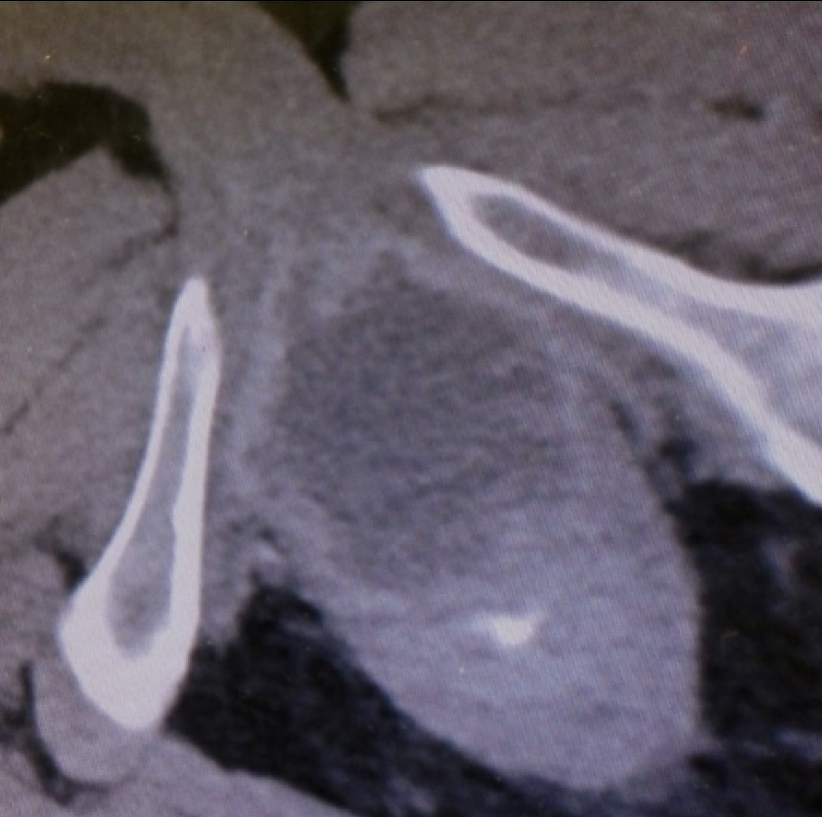 radRounds Radiology Network tweet media