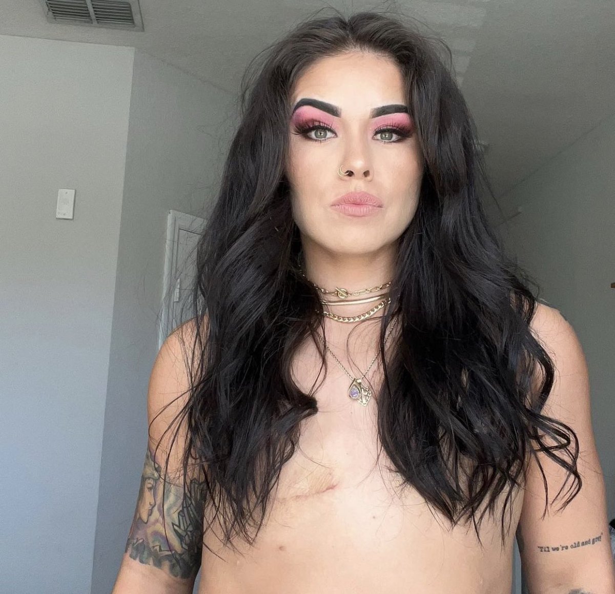 🚨 À 29 ans, alors que Stephanie est en bonne santé, elle choisit de subir une double mastectomie préventive après avoir été testée positive à la mutation du gène BRCA1. Cette mutation augmente considérablement le risque de développer un cancer du sein. La jeune femme a donc pris