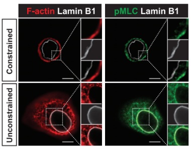Beautiful work Shiraishi et al! They show that alveolar cells plated on 10 um upatterns don't spread and retain their AT2 differentiation, unlike cells plated on larger upatterns. Actin accumulation around the nucleus and yap/taz localization also depend on upattern size🤩