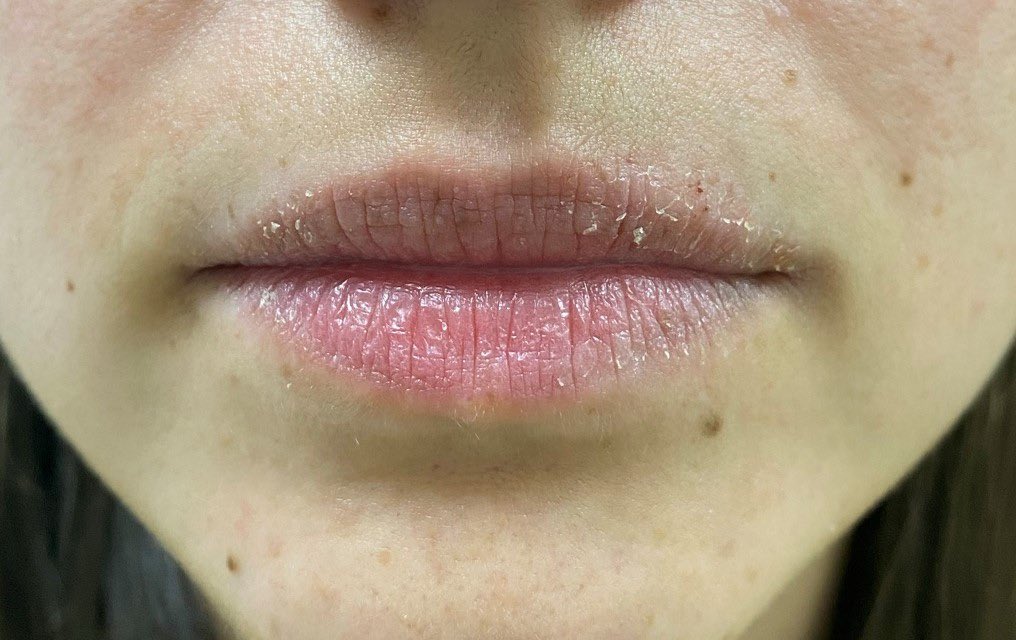 podemos exterminar a la gente que llevan los labios más tiesos que el coño de mi difunta abuela y se la pela completamente?