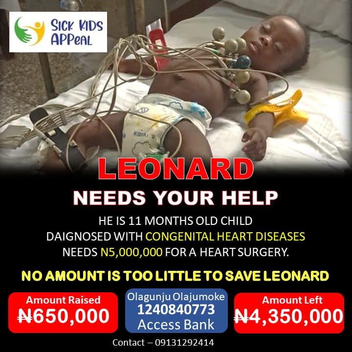 Iraadat_'s tweet photo. It has been days and weeks of raising funds for Leonard.
Note, days and weeks of living in pain, days and weeks of not living a comfortable life, for a little child like Leonard.

If you don't want him to keep wallowing in pain, you want ease for him instead, kindly donate here https://t.co/pnaoN0tOgF