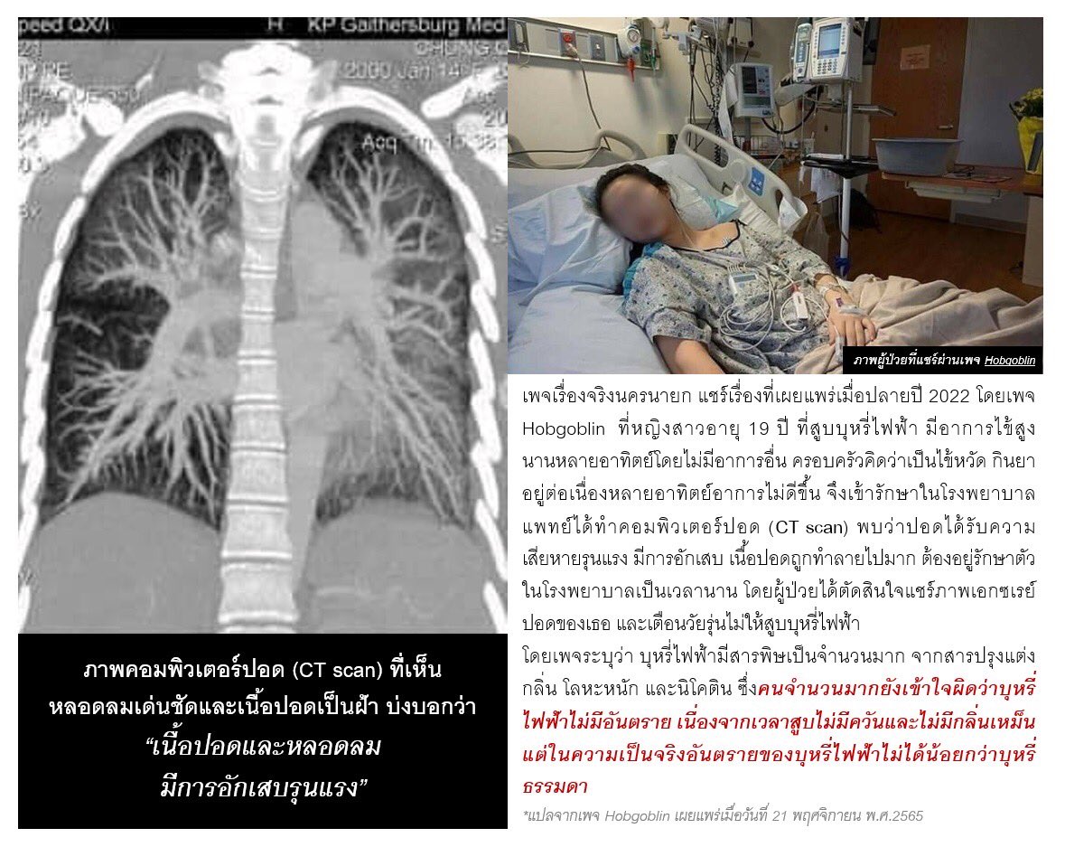 Prakit Vathesatogkit tweet media