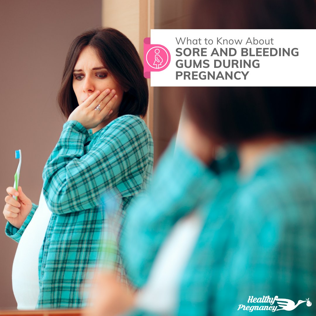 healthybabyinfo's tweet image. Along with the notorious #morningsickness and swollen ankles, sore and bleeding gums during #pregnancy is a common concern among pregnant women. 

Here are a few things to know about these gum concerns during pregnancy:

Healthypregnancy.com/sore-and-bleed…