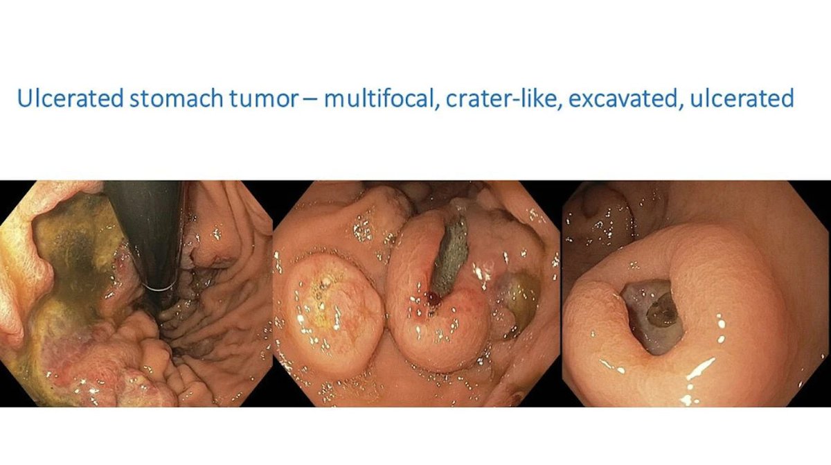 EndoCollab™ | GI Endoscopy Community tweet media