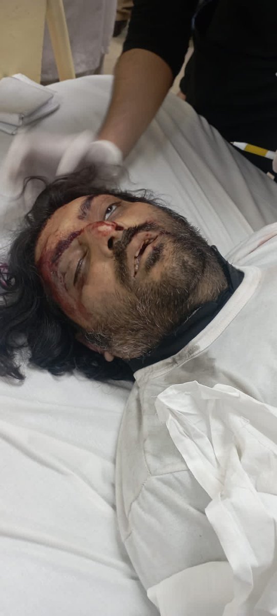 SalmanIk6's tweet photo. PTI ورکر علی بلال کو پولیس کے ظلم اور تشدد سے شہید کردیا گیا ہے۔ اس حکومت میں نہ کوئ شرم ہے نہ حیاء! #Fascist_PDM
@ImranKhanPTI مرشد
@00ZBR @A1980Noaman @A_Raza199147 @AahilKh09973063 https://t.co/0pgYTSYEKx