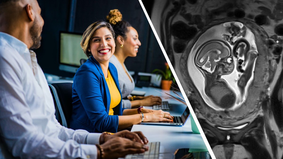 Malte Hoffmann (@mh3936) on Twitter photo Passionate about #DeepLearning and #MedicalImaging? Join our team <a href="/FreeSurferMRI/">FreeSurfer</a> <a href="/MGHMartinos/">MGH Martinos Center</a> @HarvardMed as a #postdoc, develop cutting-edge algorithms for fetal-brain #MRI. nmr.mgh.harvard.edu/~mu40/postdoc.… Passionate about #DeepLearning and #MedicalImaging? Join our team <a href="/FreeSurferMRI/">FreeSurfer</a> <a href="/MGHMartinos/">MGH Martinos Center</a> @HarvardMed as a #postdoc, develop cutting-edge algorithms for fetal-brain #MRI. nmr.mgh.harvard.edu/~mu40/postdoc.…