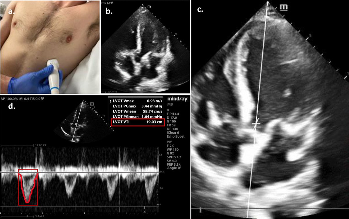 NephroPOCUS tweet media